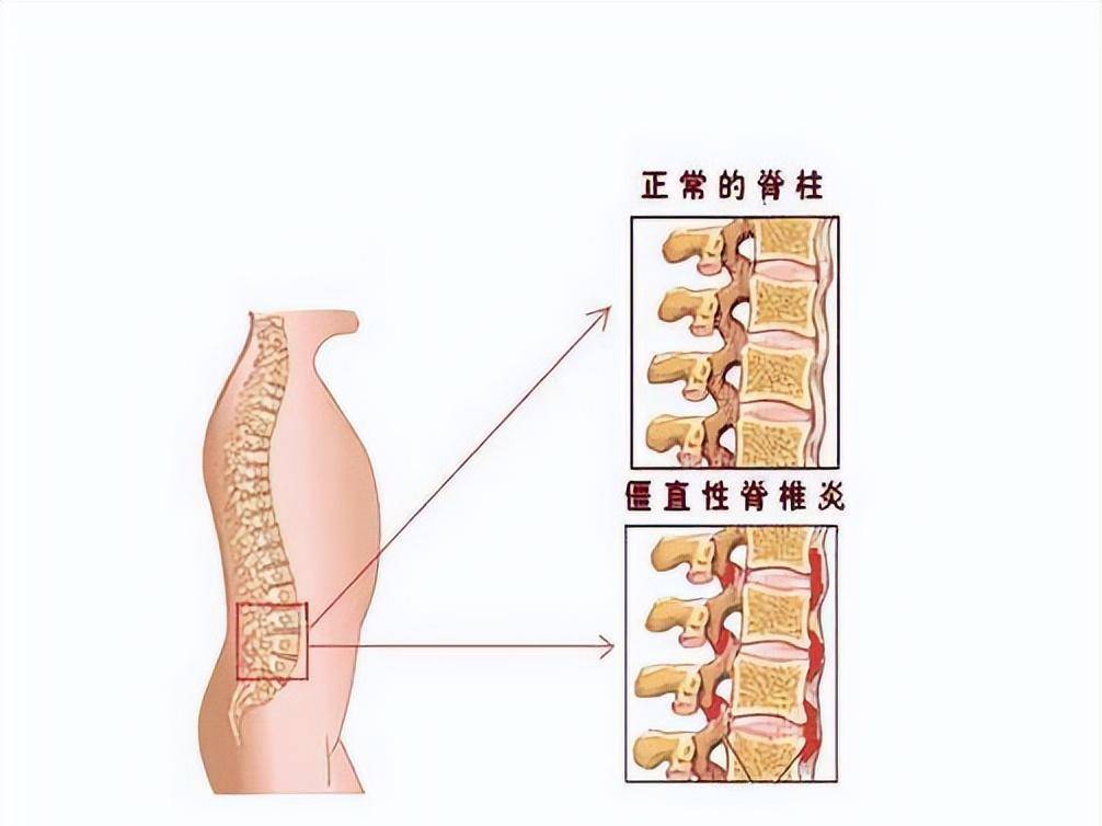 重拾活力