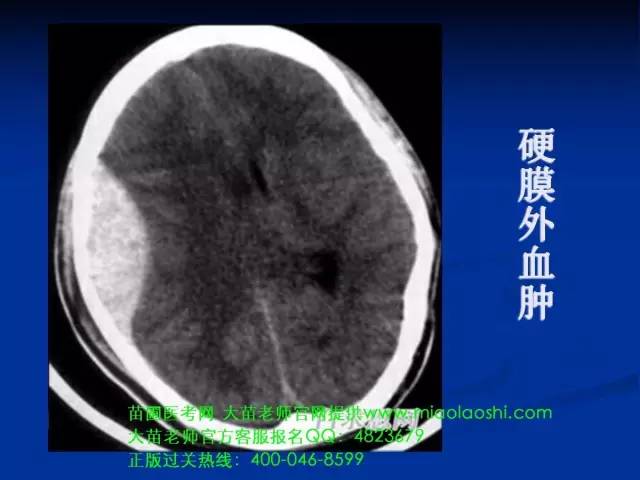 新澳精准资料免费提供510期,深奥解答解释落实_CT47.651