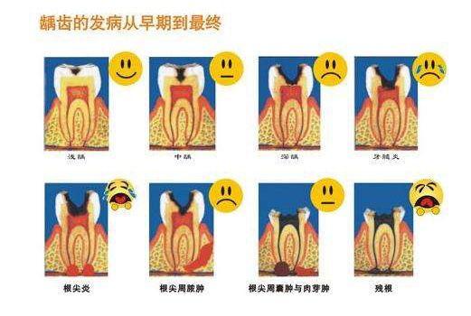 神经痛最新,神经痛最新，全面步骤指南